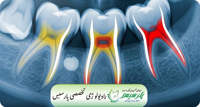Cover_Image