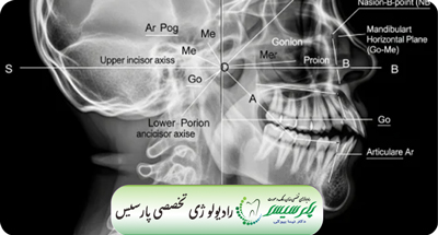 Cover_Image